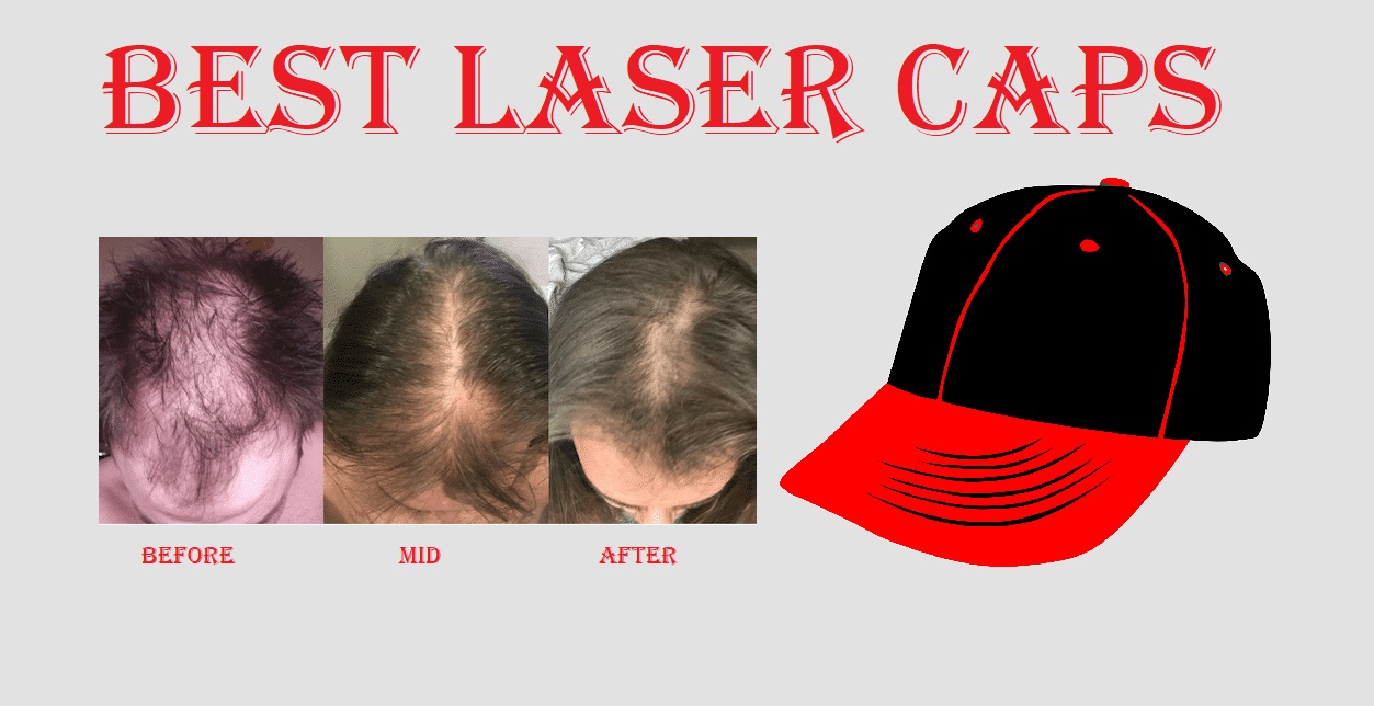 Best Laser Cap for Hair Loss 2024 (Top 3) – Laser Cap Reviews
